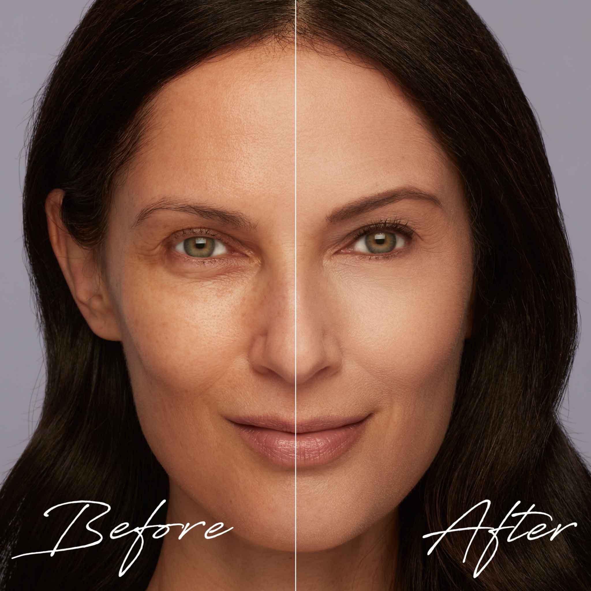 before-and-after-foundation