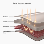 Diagram showing Radio frequency waves of CurrentBody RF device and their effects on skin layers