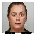 ZIIP HALO 納米微電流緊膚儀