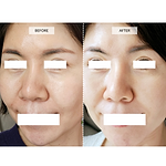 CurrentBody Skin LED 4 合 1 專用套件 No.3