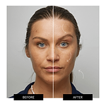 ZIIP HALO 納米微電流緊膚儀