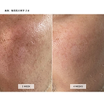 CurrentBody Skin LED 4イン1 マスク 楽天