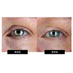 CurrentBody Skin RF ラジオ波 美顔器 楽天