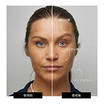 ZIIP HALO フェイシャルトーニングデバイス