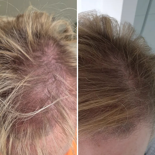 Before