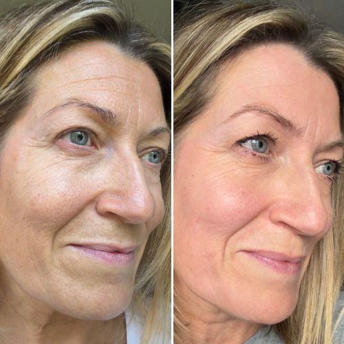 カレントボディジャパン | 美容テクノロジーエキスパート | 公式ストア