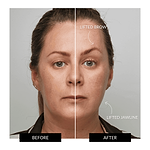 ZIIP HALO Facial Toning Device