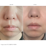 ZIIP HALO Facial Toning Device