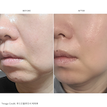 ZIIP HALO Facial Toning Device