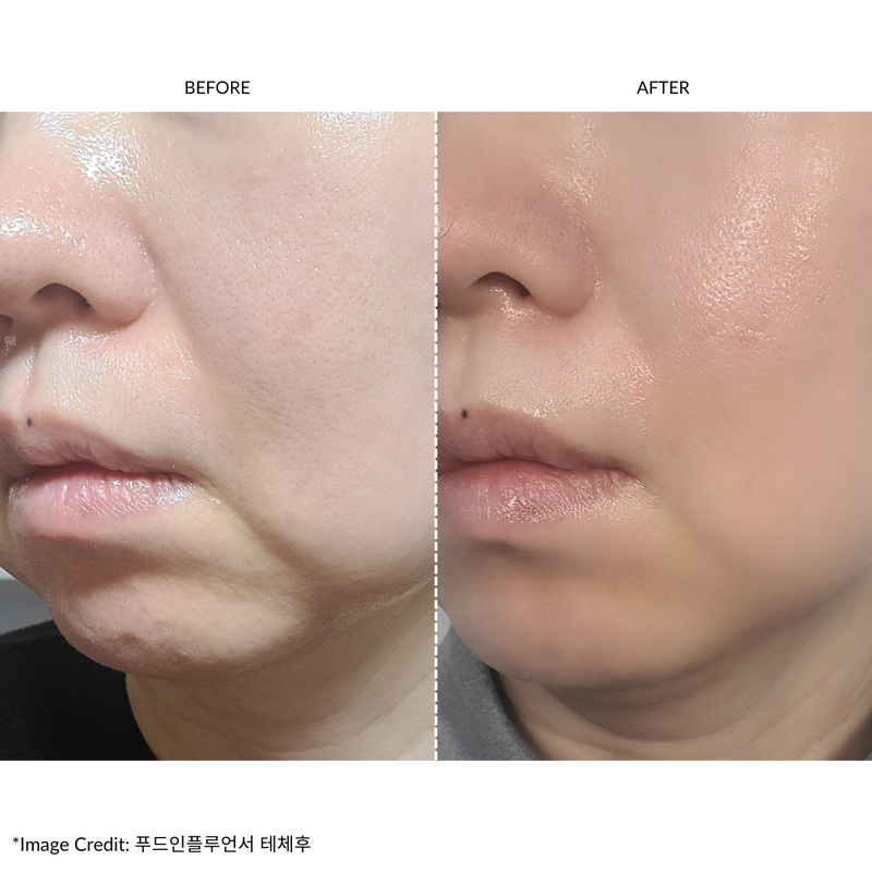 ZIIP HALO Facial Toning Device