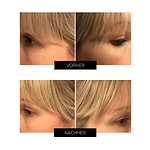 OXYjet GO Oxygen Facial System