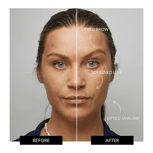 ZIIP HALO Facial Toning Device