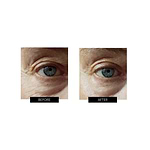 OXYjet GO Oxygen Facial System