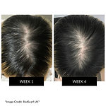 CurrentBody Skin LED Hair Regrowth Device Offer