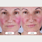 CurrentBody Skin Series 2 Led Mask Hydration & Glow Bundle