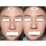 CurrentBody Skin 4-In-1 LED Face Mask