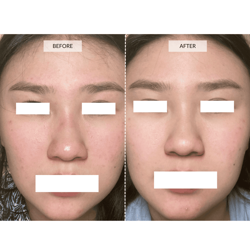 CurrentBody Skin 4-in-1 LED Face Mask | CurrentBody CurrentBody Skin 4-in-1 LED Face Mask | CurrentBody
