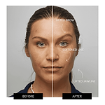 ZIIP HALO Facial Toning Device