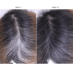 CurrentBody Skin LED Hair Regrowth Device Offer