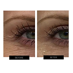 CurrentBody Skin RF Radio Frequency Skin Tightening Device Offer