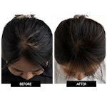 CurrentBody Skin LED Hair Regrowth Device Offer