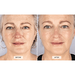 CurrentBody Skin Limited Edition LED Beauty Gift Set