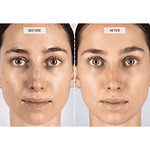 CurrentBody Skin LED 4-in-1 Face & Neck Kit (Worth $889)