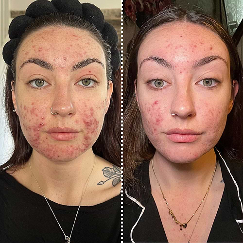 CurrentBody USA | The Beauty Tech Experts | Express Shipping
