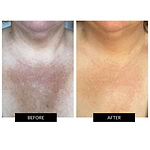 CurrentBody Ultimate Neck Care Kit