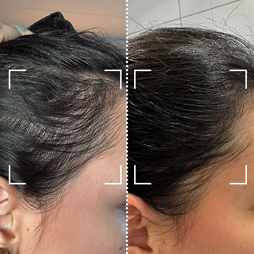 Thicker, fuller hairline