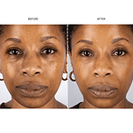 Silver Series 1 LED Mask Gift Set