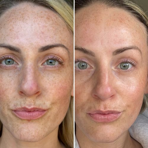 CurrentBody USA | The Beauty Tech Experts | Express Shipping