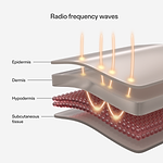 Diagram showing Radio frequency waves of CurrentBody RF device and their effects on skin layers