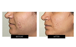 CurrentBody Skin Face, Lip & Neck Kit (worth $908)