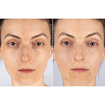CurrentBody Skin X Peter Rabbit Limited Edition LED Light Therapy Face Mask