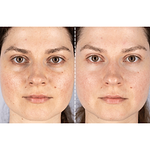 CurrentBody Skin X Peter Rabbit Limited Edition LED Light Therapy Face Mask