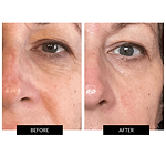 CurrentBody Skin Face, Lip & Neck Kit