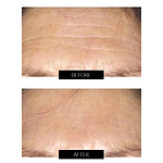 CurrentBody Skin Face, Lip & Neck Kit