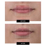 CurrentBody Skin Face, Lip & Neck Kit