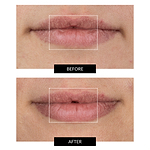 CurrentBody Skin Face, Lip & Neck Kit