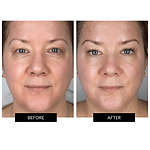 CurrentBody Skin Face, Lip & Neck Kit