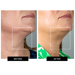CurrentBody Skin x Sonia Sélaire Skin Tightening Routine
