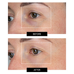CurrentBody Skin LED Eye Perfector & 5 Eye Hydrogel Masks worth $345