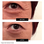 CurrentBody Skin x Sonia Sélaire Skin Tightening Routine