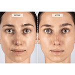 CurrentBody Skin LED Light Therapy Face Mask Offer