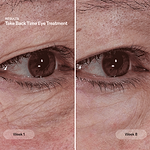 Before and after from using Trinny London eye treatment 