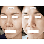CurrentBody Skin LED 4-in-1 Zonen Mapping Gesichtsmaske in Limitierter Edition