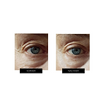 Sichtbare Vorher Nachher Ergebnisse 3