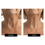CurrentBody Skin LED Hals og Bryst Perfector