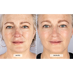 Kit Facial Antiedad Completo de CurrentBody Skin (Máscara LED Serie 1)